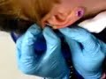 Liz Pierced 07-03-8 Industrial piercing =D avec la renee Liz Pierced 07-03-8 Industrial piercing =D avec la renee