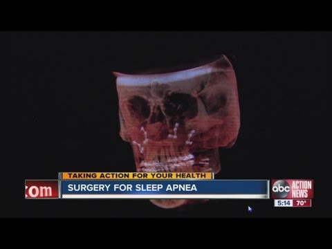 how to cure overbite