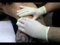 jerids monster zit or cyst part 1 (2).3gp
