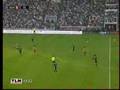 Les Bigs Ben : Benzema Ben Arfa