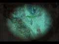 Tibia Mayor Seizure TMC3 (Hardcore Version)