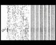 CORPUS CALLOSUM (part 1)