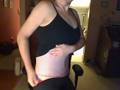 Tummy Tuck Scars so far...
