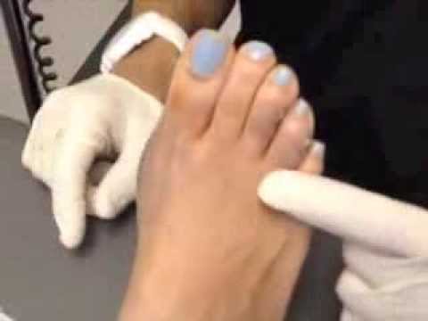 old lady bunions