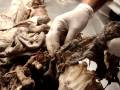 anatomia::: abdomen III