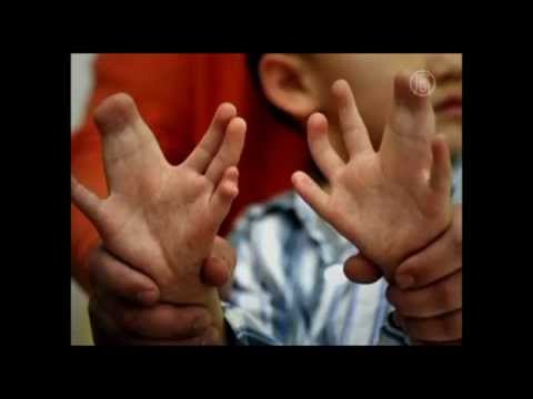 Poluição afeta crianças chinesas