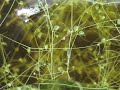 utriculaire gibba