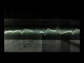 minilogue - along the lines