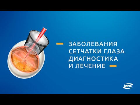 Видео Метод лечения сетчатки - лазерная коагуляция