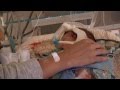 Neonatal Intensive Care for Premature Baby