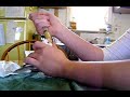 Handfeeding Baby Whitefaced Cockatiel 22 days old