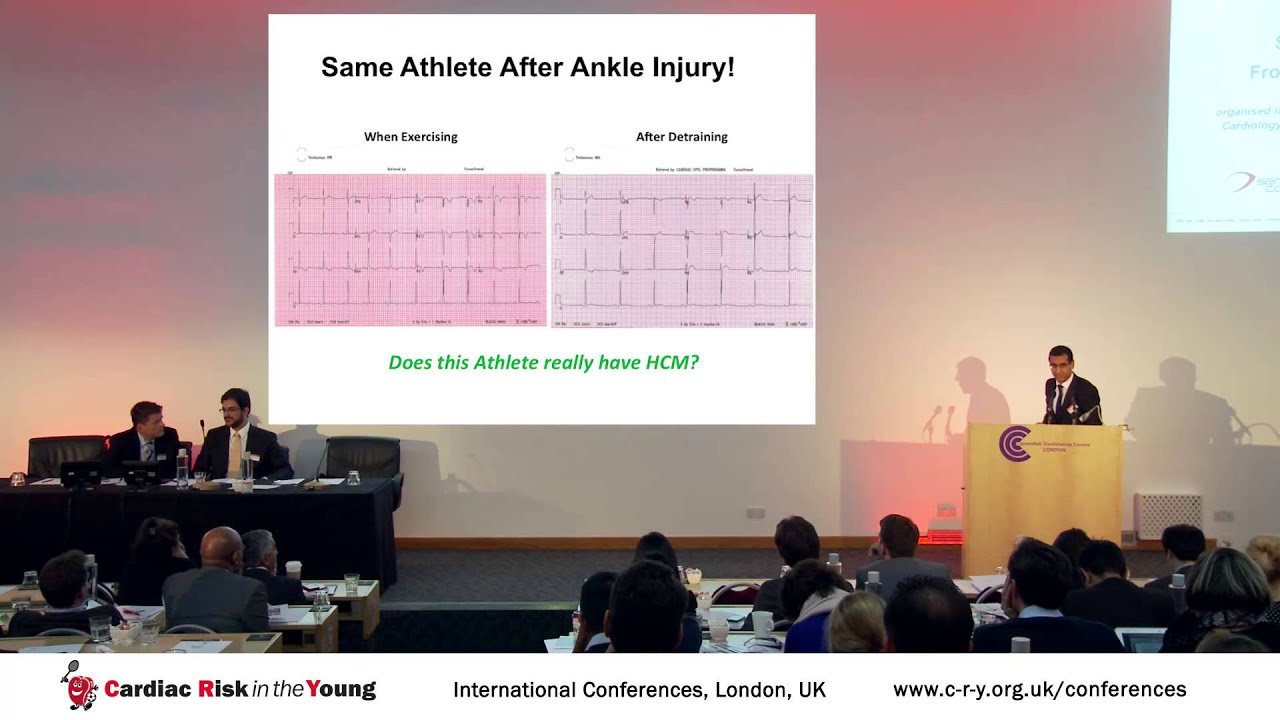 Athletes with HCM; Black and white, or fifty shades of grey