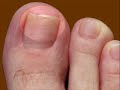 The Human Toe