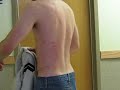 My friend in the Army had some rough sex with a girl and got his back tore up!