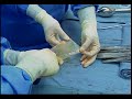 Anterior and Posterior Vaginal Repair Plus IVS Tunner