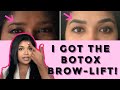 Cost Of Botox Eyebrow Lift