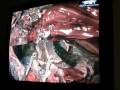 Gears of War 2 - Inside the Riftworm: Riftworm Heart