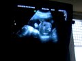 Video 22 semanas de Camila