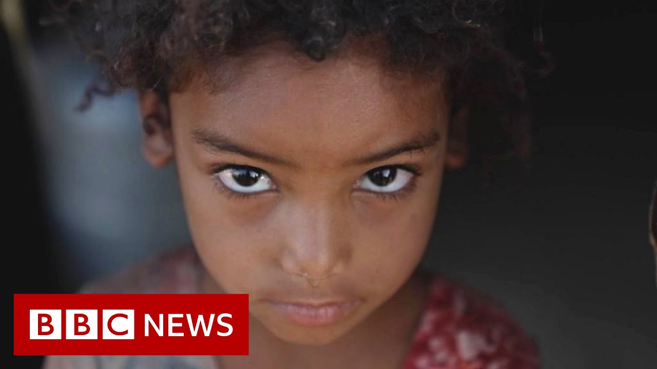Urgent UN Action needed on Yemen Atrocities to end "Pandemic of Impunity"
