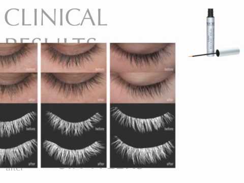 how to recover eyelashes