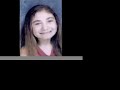 Familial Dysautonomia Cure FD Familial Dysautonomia