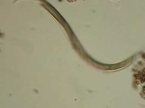 Life of a Nematode
