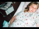 Cesarean Section (Health Tip)