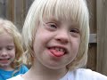 Down syndrome:&nbsp;Down Syndrome Kristina