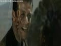 محمد فؤاد حمل جراح.wmv