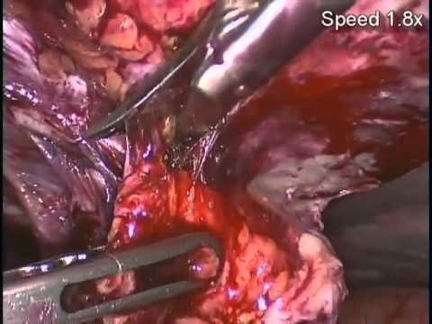 how to treat epigastric pain