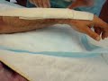changing wrapping on spider bite surgery changing wrapping on spider bite surgery