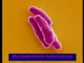 Enfermedades Infectoinfeciosas