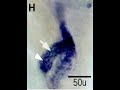 Analysis of pancreatic development in transgen zebrafish Analysis of pancreatic development in transgen zebrafish