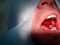 Cirurgia