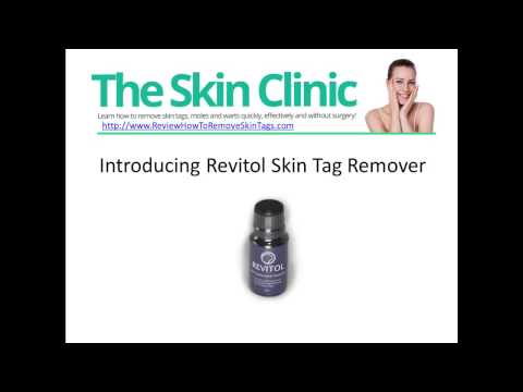 how to u get skin tags