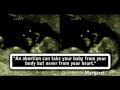 1st Way Pregnancy - Beautiful You RC01