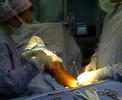 Varicose Veins Surgery ????? ??????? ?????? - ????????