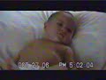 Kailani's Infantile Spasms