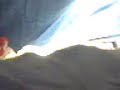 Cx luxaci�n de hombro 1a parte