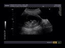 ??????? 2008/10/02 (First OB/GYN)