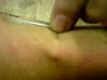 pushing wire through arm pushing wire through arm
