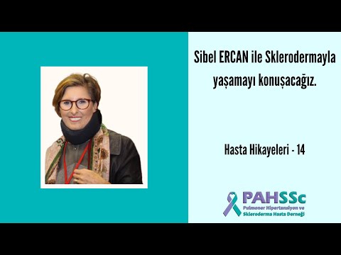Hasta Hikayeleri - Sibel ERCAN ile Sklerodermayla Yaşamak - 14 - 2020.06.11
