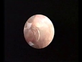Hysteroscopic endometrial ablation