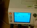 Heart Monitor