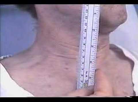 how to measure jvp