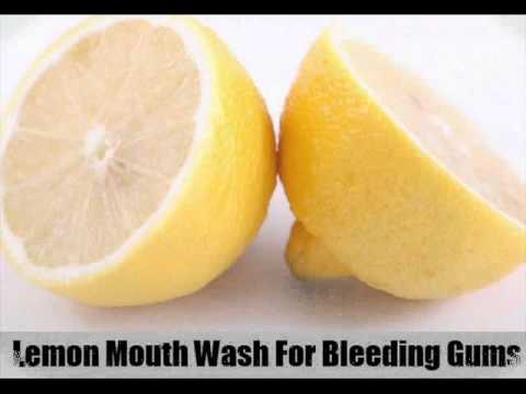 how to cure bleeding gums