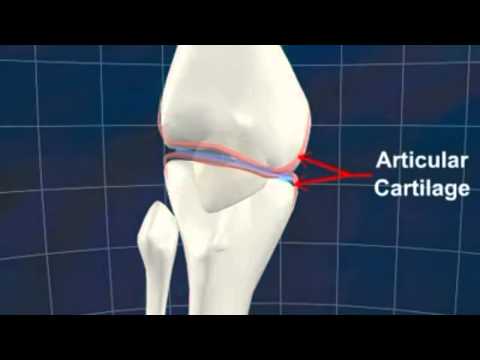 how to treat knee djd
