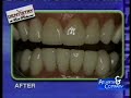 Atlanta Cosmetic Dentist Ashish C. Patel DDS Atlanta Cosmetic Dentist Ashish C. Patel DDS