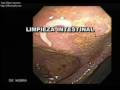 LIMPIEZA INTESTINAL. DPS