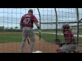 YouTube - Yadier Molina Injury Update - St. Louis Cardinals